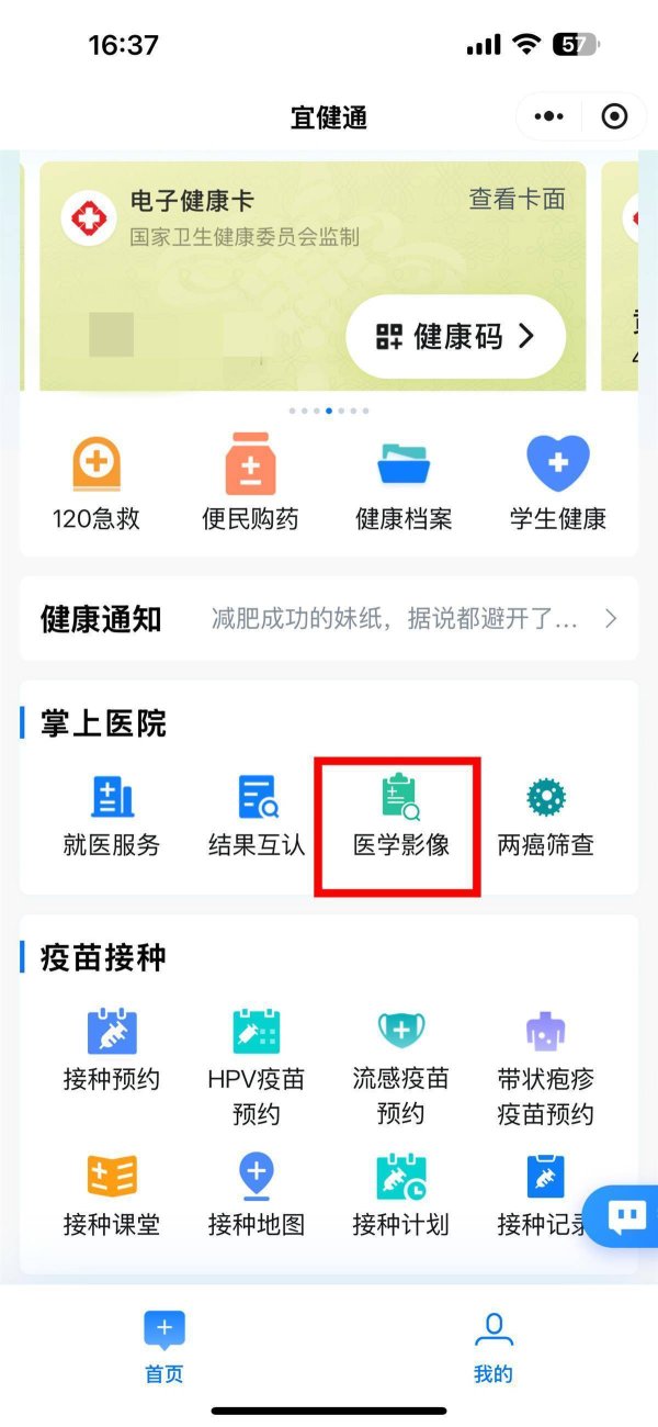 八戒策略 宜昌重大利好！再也不用拎着胶片求医